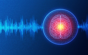 File image representing brain activity